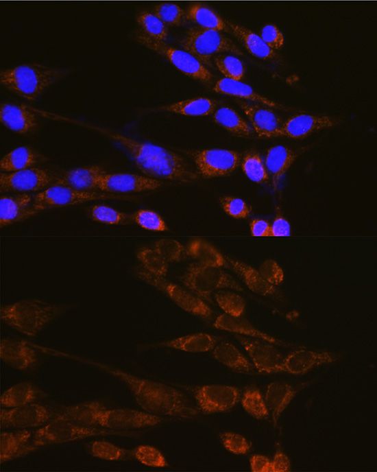 Dynamin 2 antibody