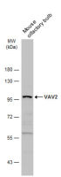 VAV2 antibody
