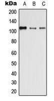 Desmoglein 4 antibody