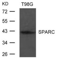 SPARC antibody