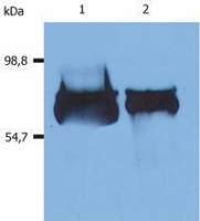 Albumin antibody [AL-01] (Biotin)