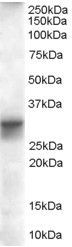 FHL1 isoform B antibody, Internal