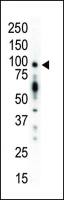 PKC mu antibody