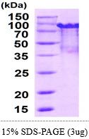 Mouse PRMT1 protein, His and MBP tag (active)