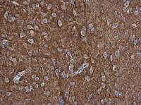 pan Synuclein antibody