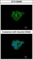 AChR alpha 3 antibody