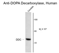 DOPA Decarboxylase antibody