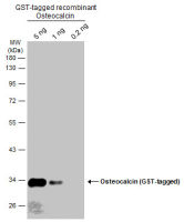 Osteocalcin antibody