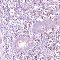 PKA beta (catalytic subunit) antibody