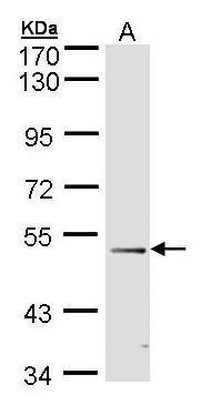 FOXD1 antibody [C3], C-term