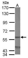 EIF3D antibody