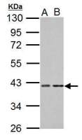 PKA C alpha antibody