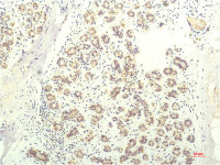 STAT1 antibody [5H7]