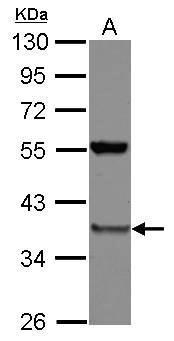 PSMD8 antibody