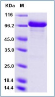 Human Alpha fetoprotein / AFP protein, human IgG1 Fc tag