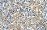 MARVELD3 antibody, Internal