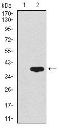 CD59 antibody [8D2B8]