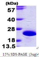 Human NCS1 protein, His tag