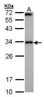 Calcipressin 1 antibody