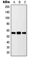 Cytochrome P450 2D6 antibody