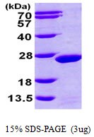Human MDP1 protein, His tag
