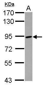 ADAM8 antibody