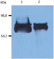 Albumin antibody [AL-01]