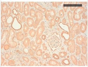 basic Cytokeratin antibody [AE3]