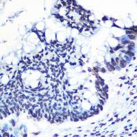 NFkB p65 (phospho Ser276) antibody