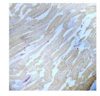 IKK alpha (phospho Ser180) + IKK beta (phospho Ser181) antibody