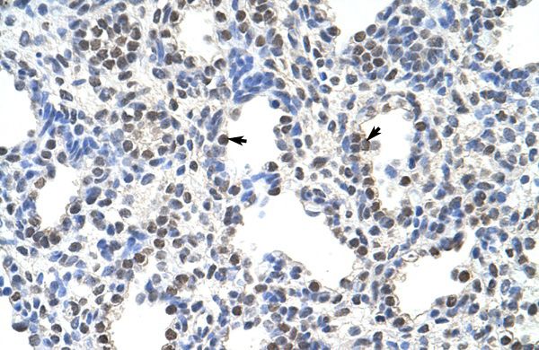 FUSIP1 antibody, C-term