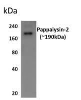 Pappalysin 2 antibody [8M12]