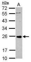 PRKCDBP antibody
