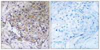 WASF3 antibody
