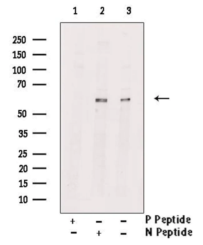RIP3 (phospho Ser232) antibody