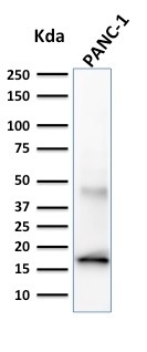 Elastase 3B antibody [CELA3B/1257]