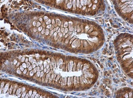 Selenoprotein P antibody