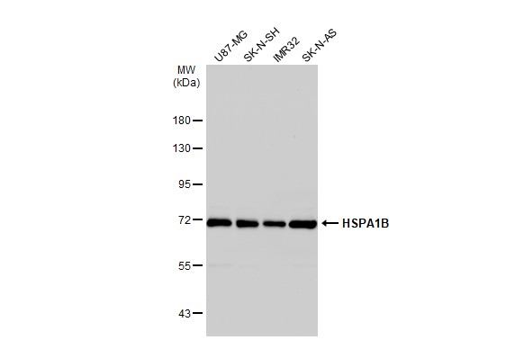 Hsp70 antibody