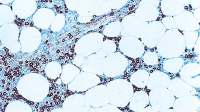 Myeloperoxidase antibody [59A5]