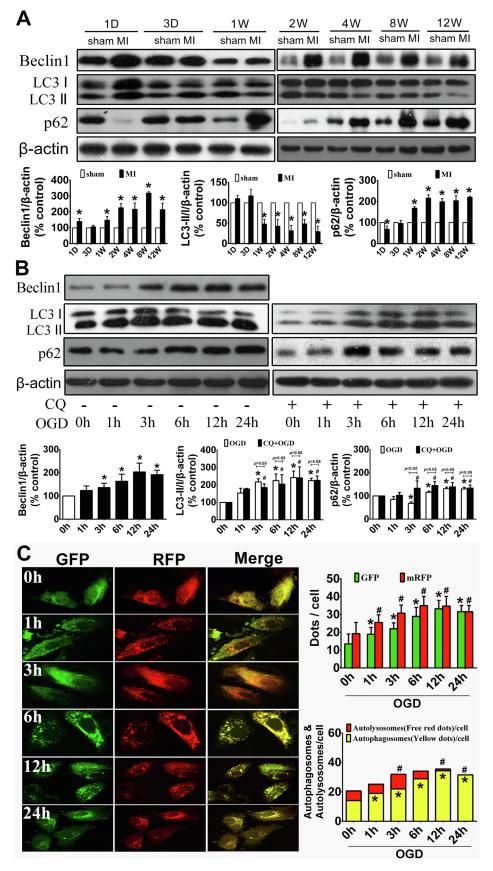 低氧/厌氧产品案例——低氧与心梗研究2