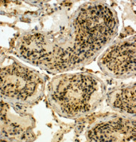 EDD antibody, C-term