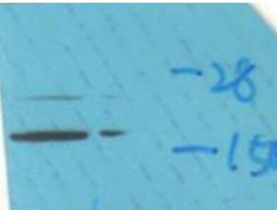 Calmodulin (phospho Thr79/Ser81) antibody