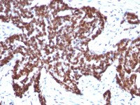 Cyclin B1 antibody [CCNB1/1098]
