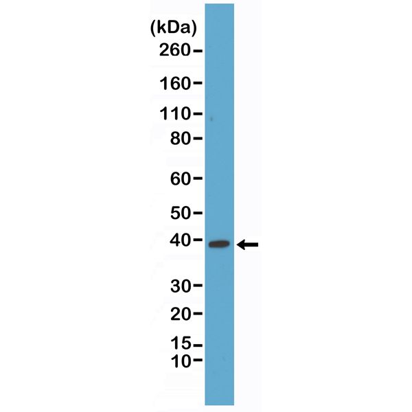 p38 MAPK antibody [RM245]