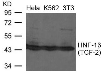 HNF1 beta antibody