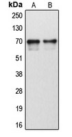 CYP1B1 antibody