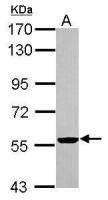 Cytokeratin 2 antibody