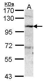 VAP1 antibody