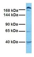 ABCC9 antibody, Internal