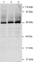 KSHV LANA2 antibody [CM-A807]